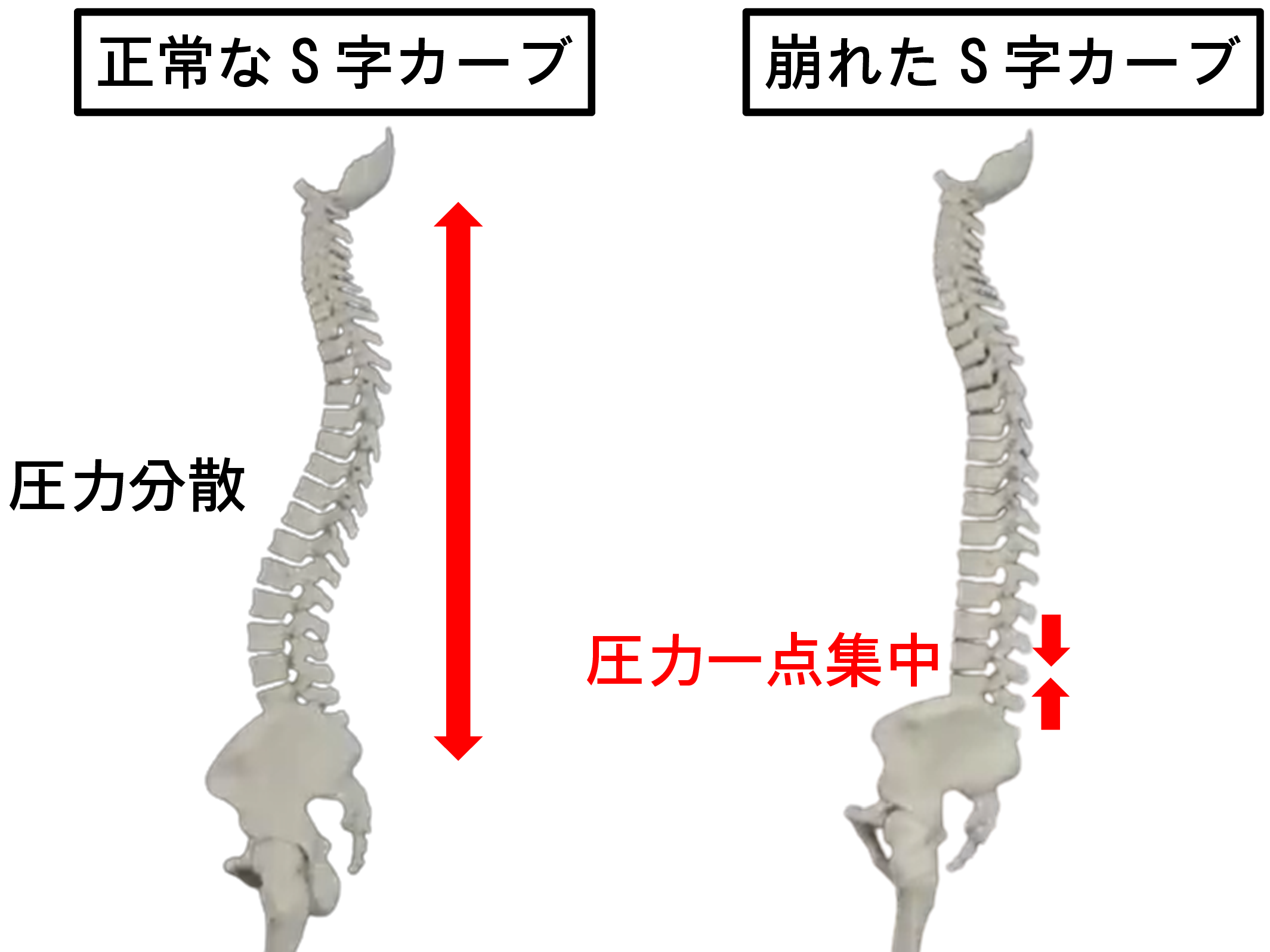 腰椎カーブ