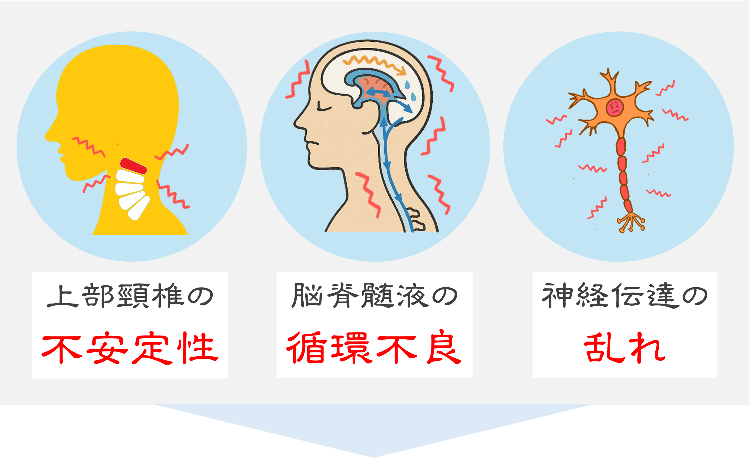 腰椎分離・すべり症 腰椎分離・すべり症
