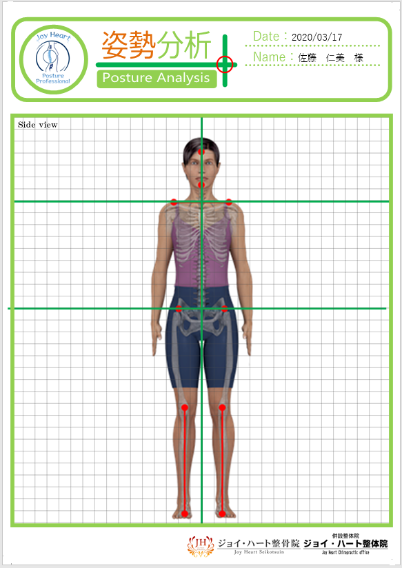 姿勢分析　正面